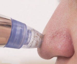 Blackhead Extracting Pore Vacuum