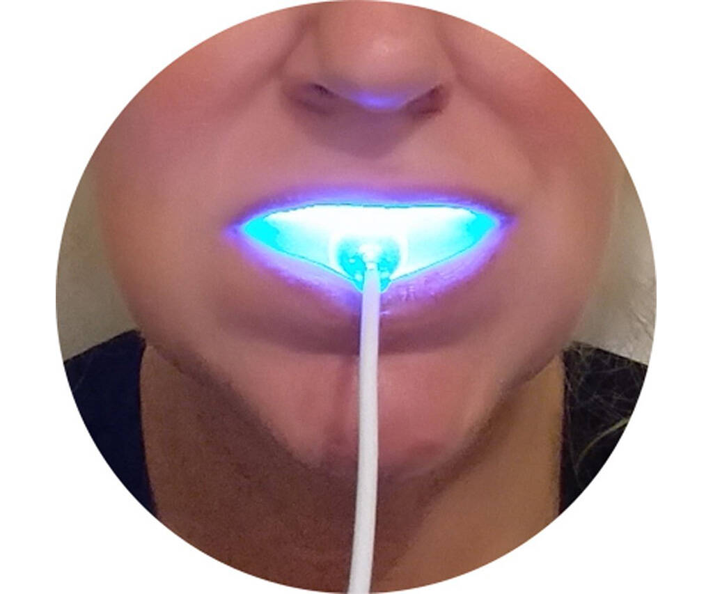 Teeth Whitening Light - http://coolthings.us
