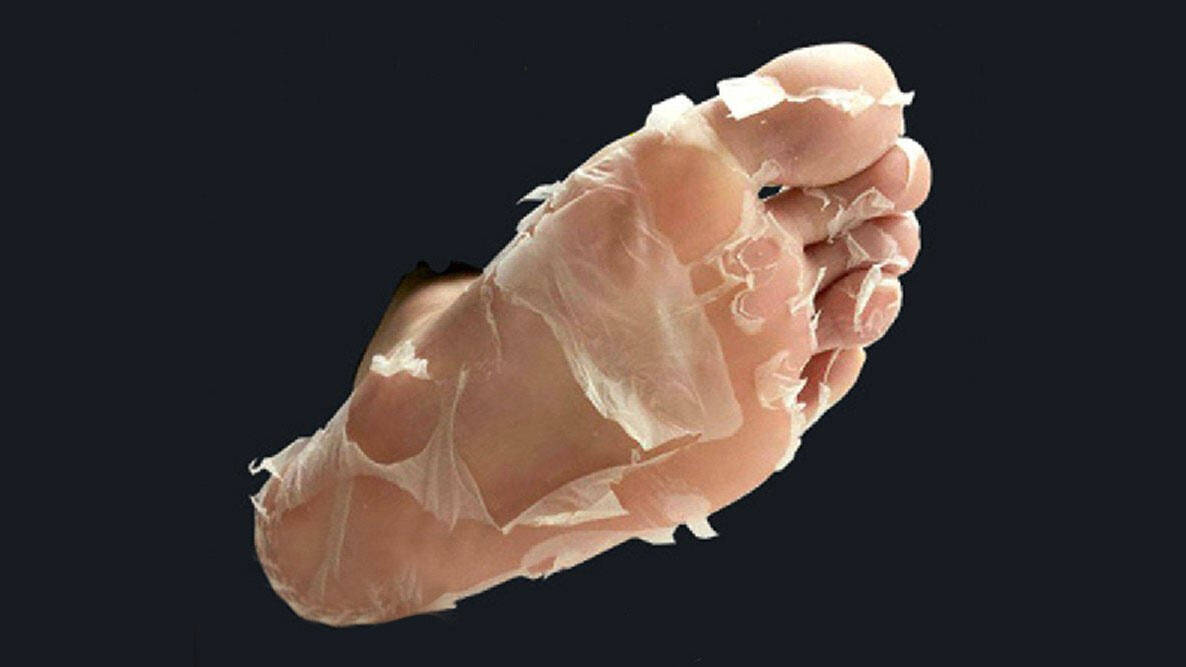 Baby Foot Human Molting Peel - //coolthings.us