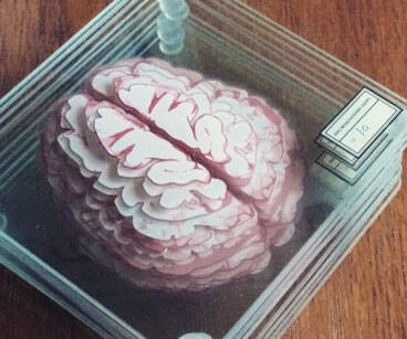 Brain Specimen Coasters - coolthings.us