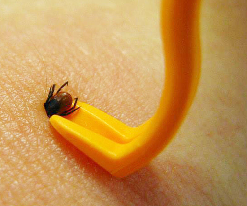 Tick Removing Tweezers - //coolthings.us