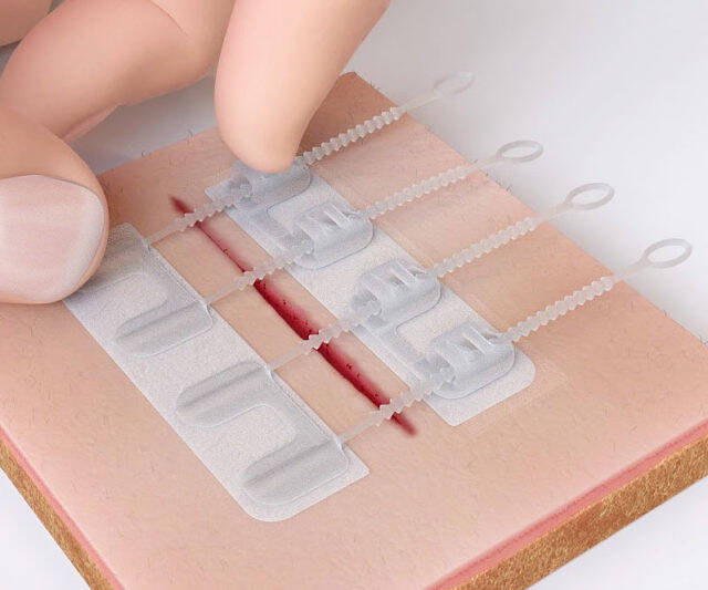 ZipStitch Laceration Kit - //coolthings.us
